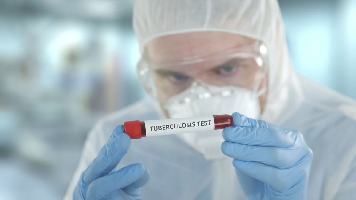 Pomáhá proti viru vakcína na TBC? Experti by americkou studii nepřeceňovali
